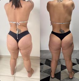 Transformação real — 12 SEMANAS